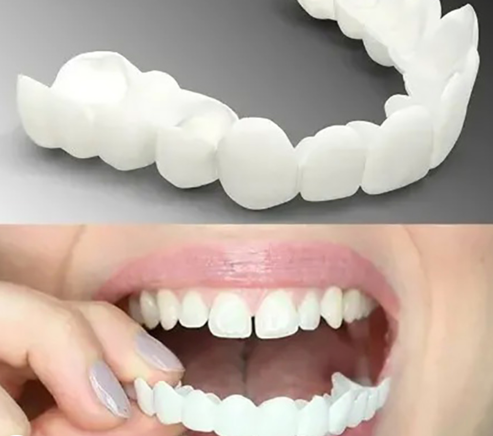 Close-up of snap-on dentures, showing how they provide a perfect, instant cosmetic smile. Reusable teeth.